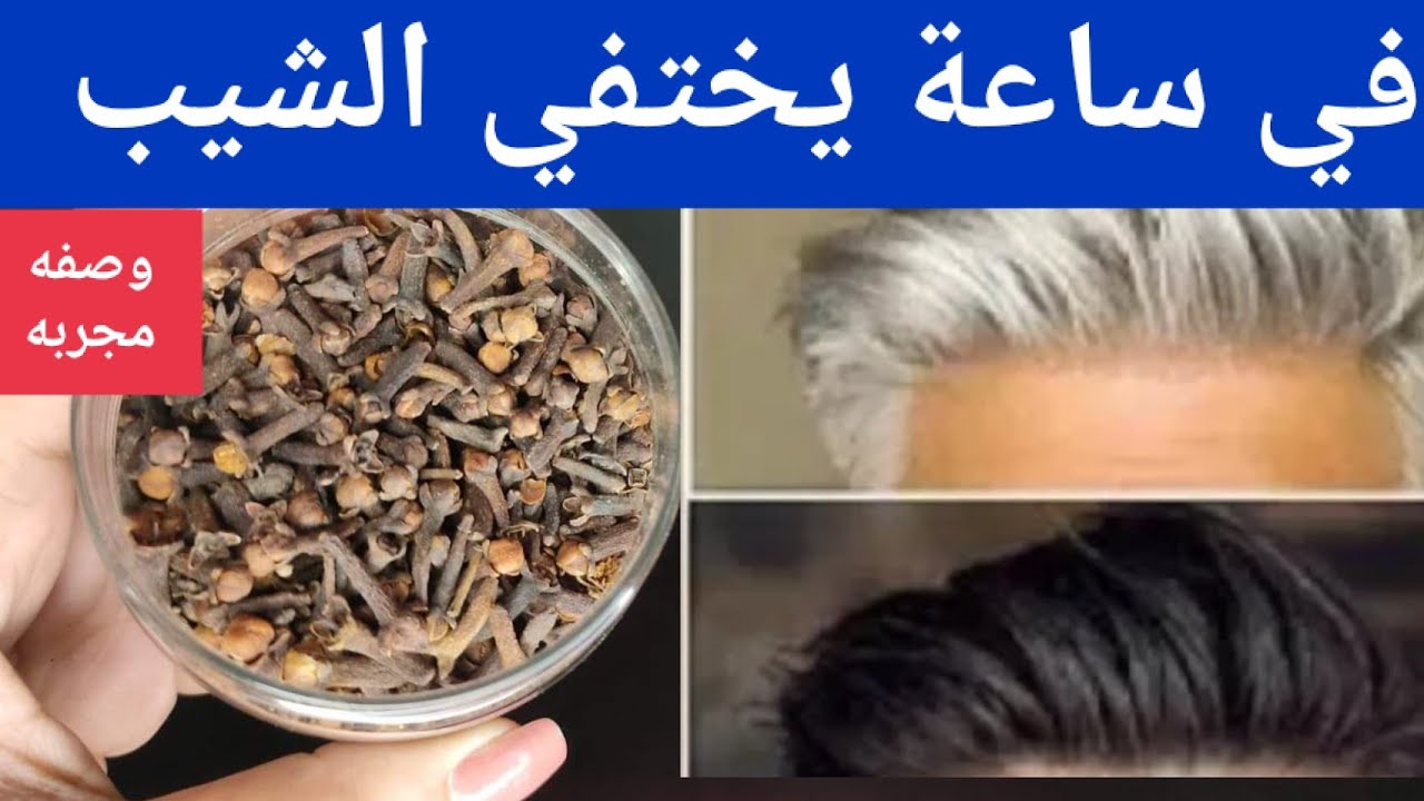 خلطة سوريا رهيبة جدا…القرنفل هدية ربانية تعالج الشيب وبدون حنة ولاصبغات في ساعة تختفي الشيب بلون ثابت